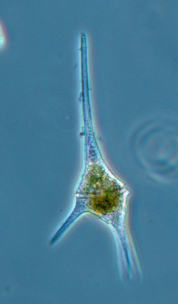 Das Bild 1 zeigt ein Exemplar der besagten Alge Ceratium hirundinella. 