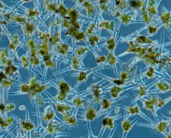 Die Mikroskopaufnahme vieler Algenzellen dieser Art verbildlicht die Braunfärbung des Gewässers, die von einer Massenentwicklung dieser Algenart ausgeht. 